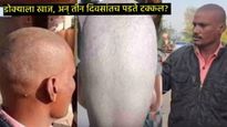 डोक्याला खाज तीन दिवसांत पडत आहे टक्कल, बुलढाण्यात विचित्र आजारामुळे नागरिकांमध्ये भीतीचं वातावरण