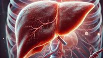Liver cancer : लिव्हर कँन्सर रुग्णांसाठी इम्युनोथेरपी उपचार आशेचा किरण, नव्या जीवनाची संधी