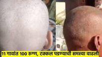 बाब्बोव..! 11 गावांत 1०० रुग्ण; टक्कल पडण्याचा संसर्गाने बुलढाणा हैराण, आरोग्य विभाग म्हणतो...