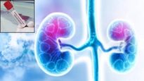 Kidney function test : ही टेस्ट तुमची किडनी खराब होण्याआधीच सांगेल आरोग्य, वर्षात एकदा करावी चाचणी