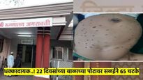 धक्कादायक! २२ दिवसांच्या बाळाला दिले ६५ चटके; 'त्या' गावात अंधश्रद्धेतून केला भयानक प्रकार 