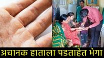 केस-नख गळतीनंतर आता हाताला पडताहेत भेगा!, महाराष्ट्राच्या या जिल्ह्यात आजाराचे थैमान,लोकांमध्ये दहशत