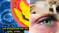 Health Tips:तुमच्या चेहऱ्यावर जर ही लक्षणे दिसली तर सावधान,बॉडीत वाढले कोलेस्ट्रोल, करू नका दुर्लक्ष