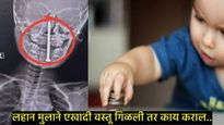 Utility Health News :  लहान मुलाने खेळताना औषध किंवा नाणं गिळलं तर काय करावे अन् काय करू नये? 