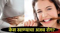 अरे बाप! 10 वर्षीय मुलीच्या पोटात अर्धा किलो केसांचा गोळा, ती केस खायची, नेमका काय आहे आजार? 