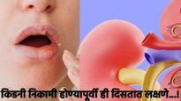 चेहऱ्यावर 'हे' 6 लक्षणे दिसली तर समजा तुमची किडनी होतेय निकामी, त्वरीत घ्या डॉक्टरांचा सल्ला! 