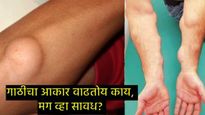 Health News : शरीरावर गाठ वाढतेय का?, मग वेळीच व्हा सावध! असू शकतो 'या' कॅन्सरचा धोका!  