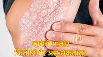 त्वचारोग आता गंभीर आजार: WHOने घेतला मोठा निर्णय, Essential Medicines List मध्ये 'या' औषधांचा समावेश