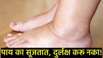 पाय सुजून दगडासारखे कठीण होतायत? दुर्लक्ष करू नका, असू शकतो 'या' गंभीर आजारांचा संकेत! 