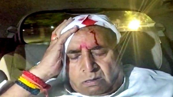 भाजप म्हणतंय, हल्ला ही अनिल देशमुखांचीच 'स्टंटबाजी'; एसपींनीही दिली हल्ल्याची माहिती