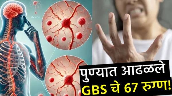पुण्यात गुइलेन-बॅरे सिंड्रोम या दुर्मिळ आजाराचे आता 67 रुग्ण! जाणून घ्या किती धोकादायक आहे हा आजार