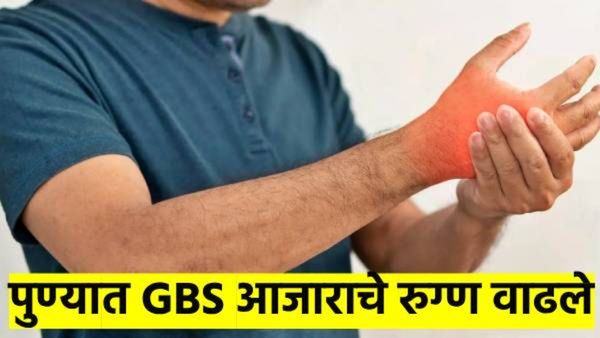 सावधान... पुण्यात GBS आजाराचे रुग्ण वाढले; १५ जण व्हेंटिलेटवर, अजित पवारांनी घातले लक्ष