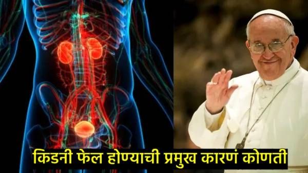पोप फ्रान्सिस यांच्या बल्ड रिपोर्टमध्ये किडनी फेलचे संकेत; 'ही' 7 लक्षणे असल्यास किडनी होईन निकामी..