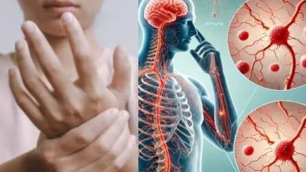 पुणेकरांनो काळजी घ्या, गिलेन-बॅरे सिंड्रोमच्या आतापर्यंत 197 रुग्ण, हा आजार किती धोकादायक ?