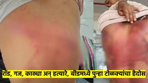 संतोष देशमुख प्रकरणाची बीडमध्येच पुनरावृत्ती; टोळक्याच्या हल्ल्यात चौघे गंभीर जखमी, काय झाले? वाचा