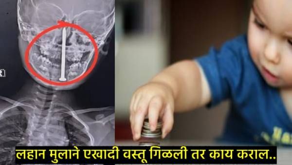 Utility Health News : लहान मुलाने खेळताना औषध किंवा नाणं गिळलं तर काय करावे अन् काय करू नये?