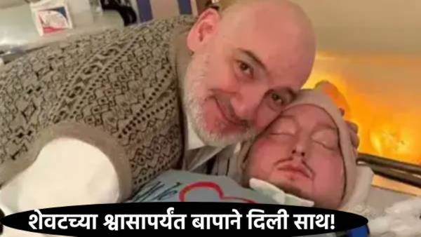 20 वर्षे 'झोपेत' राहिलेल्या 'स्लीपिंग प्रिन्स'चे निधन; वाचा-एका पित्याच्या प्रेमाची हृदयद्रावक कहाणी