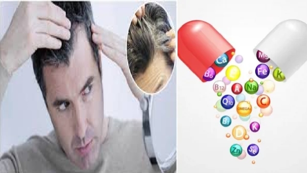 White hair White hair