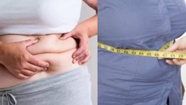 PCOD and Obesity Know How to Differentiate PCOD and Obesity Know How to Differentiate