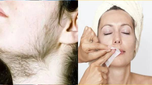 Hair removal cream disadvantages