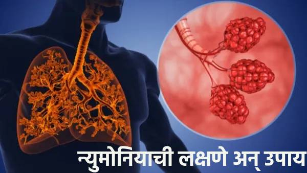 Health News Cough and shortness of breath are pneumonia symptoms