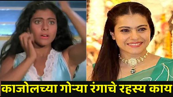 kajol did not undergo surgery