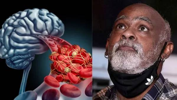 Vinod Kambli diagnosed a blood clot in his brain