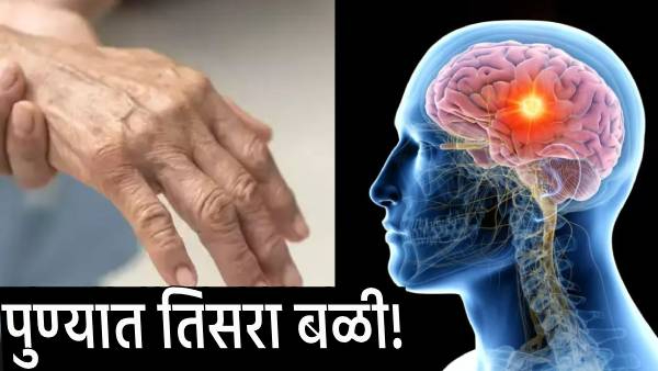 GBS disease 3rd victim in Pune Woman dies GBS disease 3rd victim in Pune Woman dies