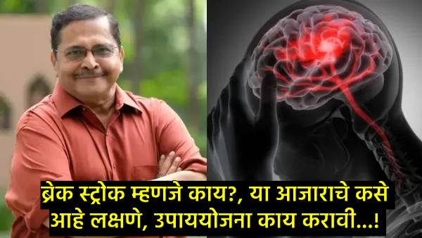 What is brain stroke What is brain stroke