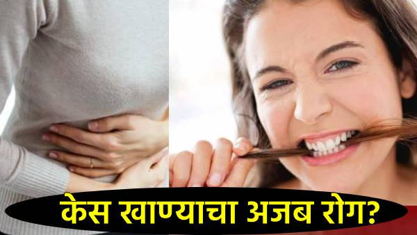 Half a kilo of hair ball in stomach Half a kilo of hair ball in stomach