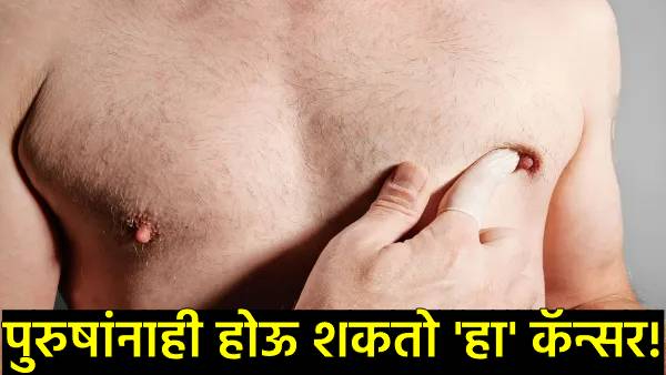 Male breast cancer symptoms causes treatment Male breast cancer symptoms causes treatment