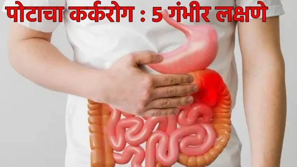 Stomach Cancer Early Warning Signs Stomach Cancer Early Warning Signs