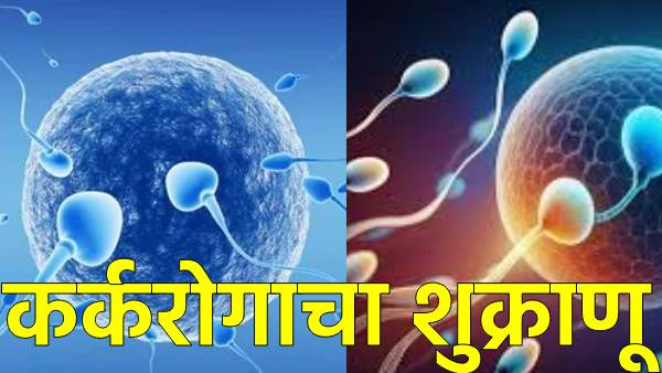 Cancer Risk Sperm Donor Cancer Risk Sperm Donor
