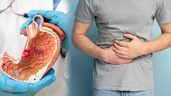 Stomach Cancer 5 Early Symptoms