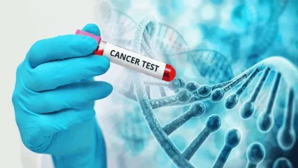 Cancer Detection Tests marathi news Cancer Detection Tests marathi news