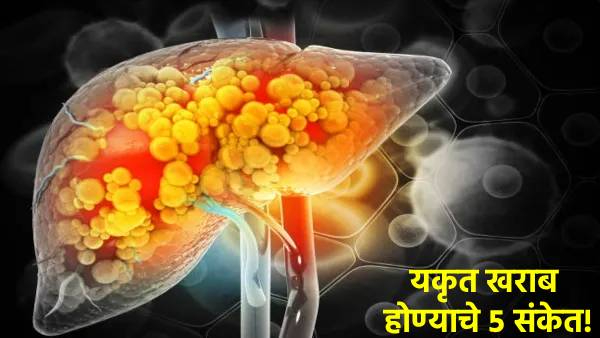 early signs of liver damage symptoms prevention tips marathi early signs of liver damage symptoms prevention tips marathi
