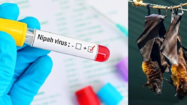 nipah virus