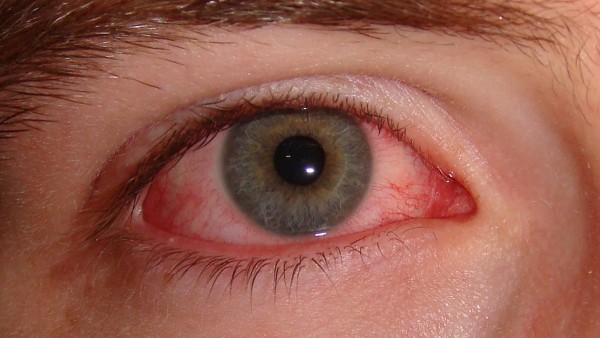 eye