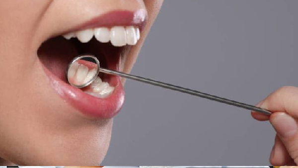 Symptoms of mouth cancer Symptoms of mouth cancer