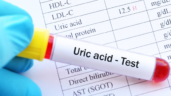 uric acid