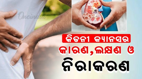 Kidney cancer causes symptoms diagnosis