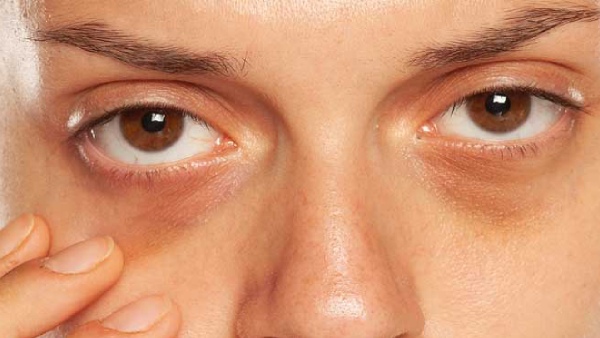 eye