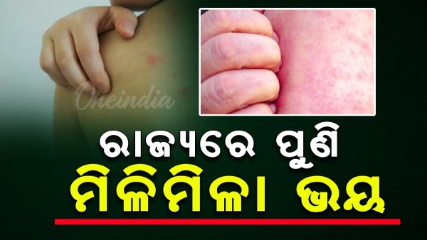 Measles