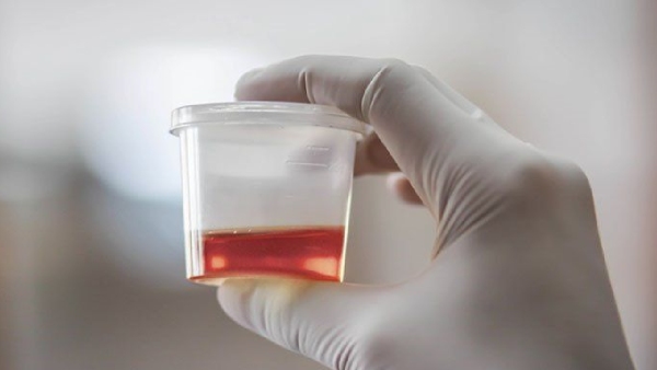 urine