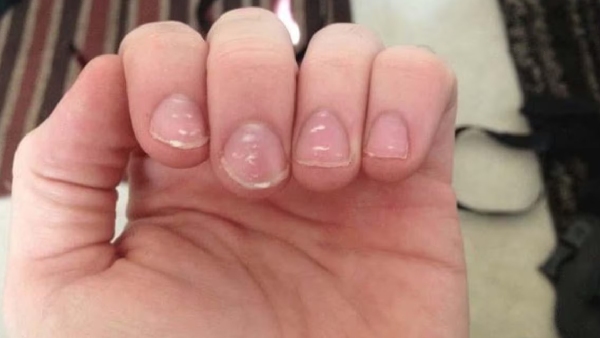 nails