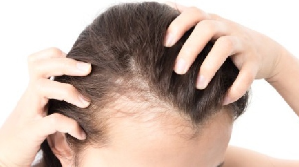 Methi Hair Packs To Stop Hair Fall