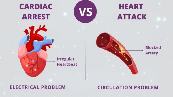 What is Heart Attack and Cardiac Arrest Let s find out
