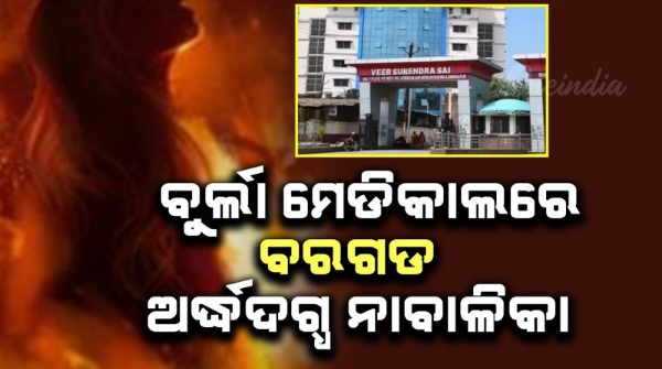 Bargarh minor girl partially burnt at Burla Medical