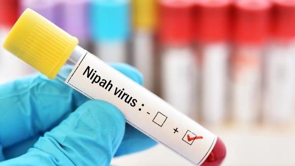 Nipah virus