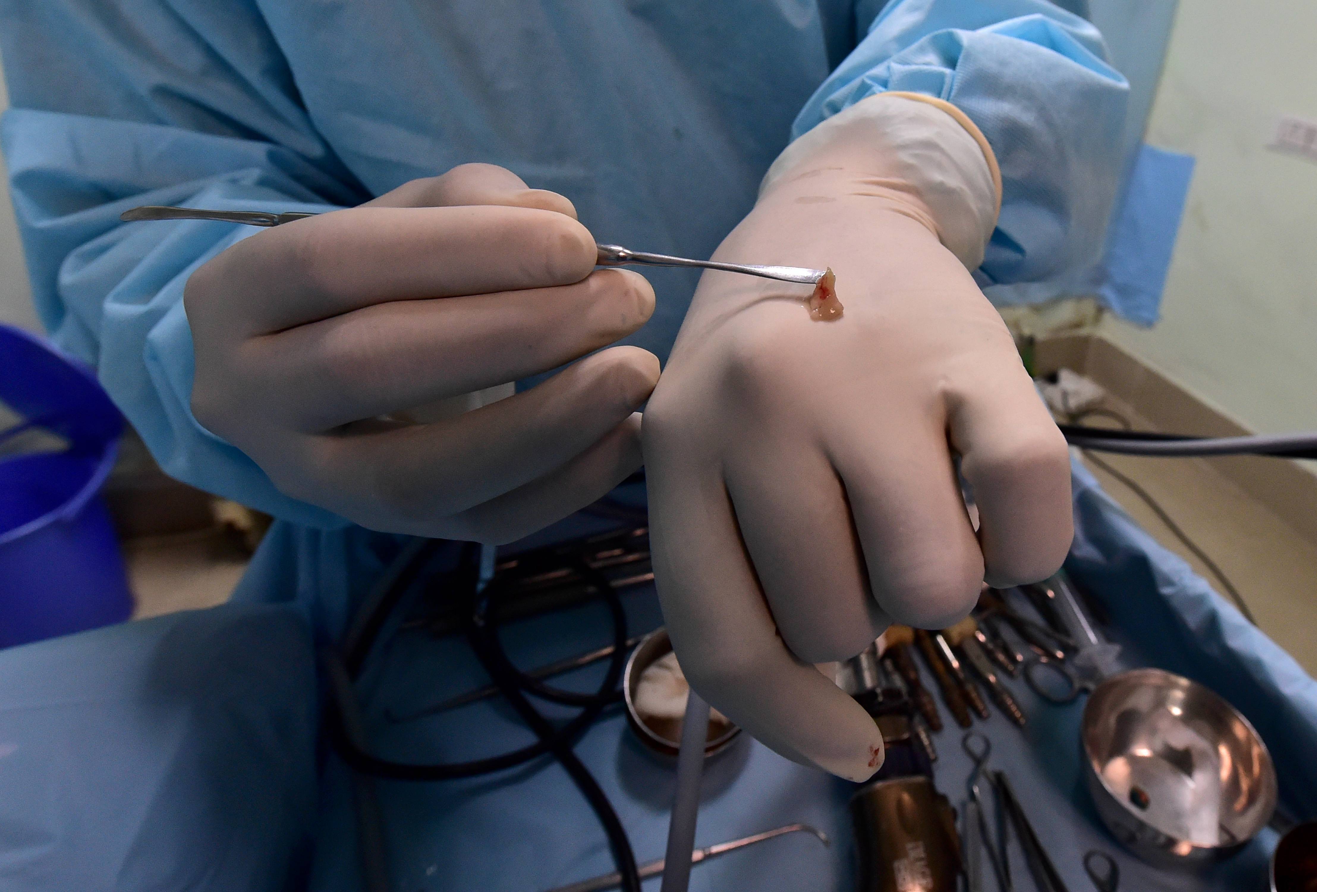 ബ്ലാക്ക് ആൻഡ് വൈറ്റ് ഫംഗസ് ബാധയേറ്റ രോഗിക്ക് നിർണായക ശസ്ത്രക്രിയ- ചിത്രങ്ങൾ